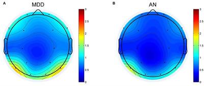 Theta oscillations: A rhythm difference comparison between major depressive disorder and anxiety disorder